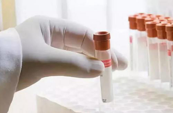 体外诊断试剂CE认证怎么进行 申请流程要点有哪些