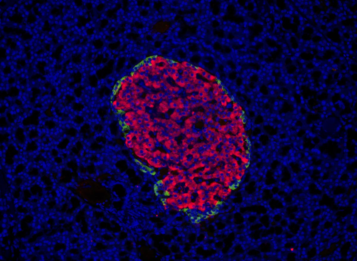 大鼠胰腺。染色：DAPI AF555 Cy5