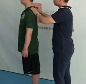 脊柱侧弯的评估及康复方法 图片